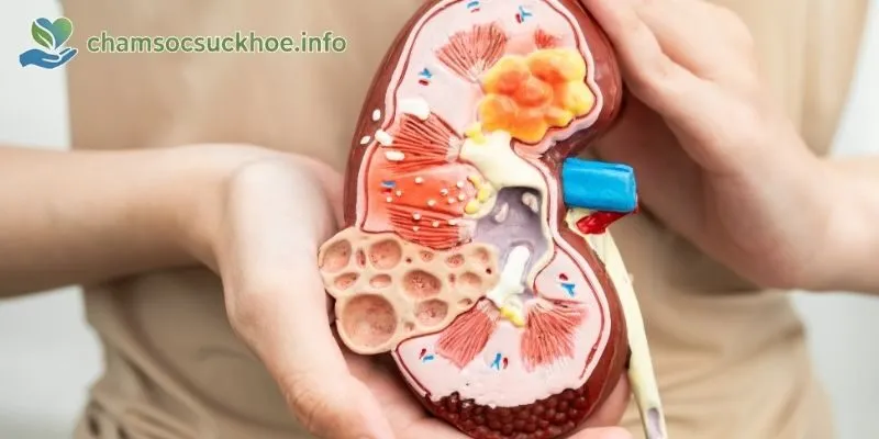 Cách phòng ngừa và giữ gìn sức khỏe thận