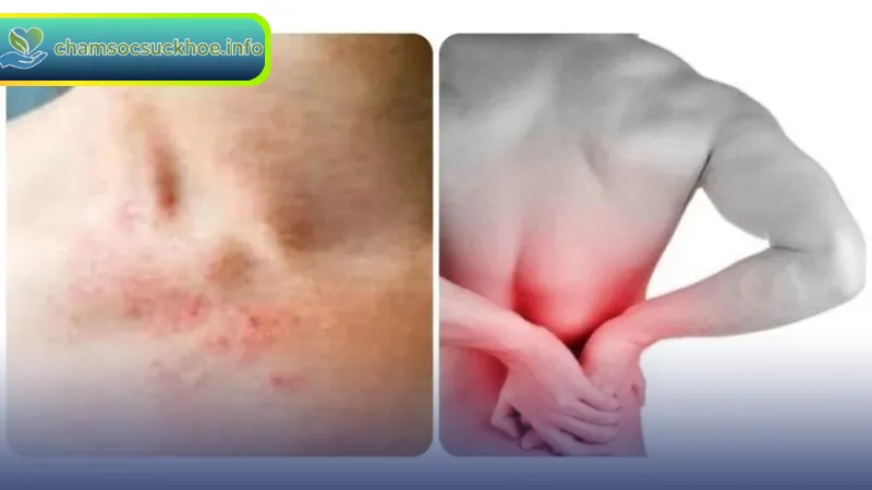 Những triệu chứng ban đầu của suy thận