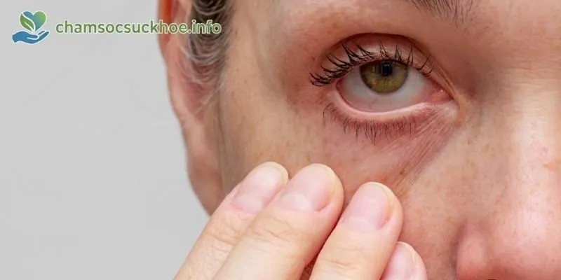 Cách phòng tránh bệnh đau mắt đỏ hiệu quả