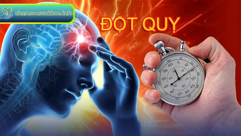 Các loại đột quỵ thường gặp