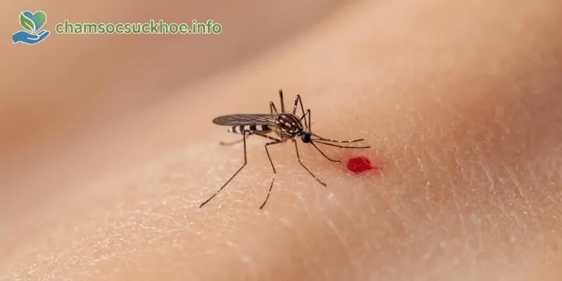Sốt Xuất Huyết
