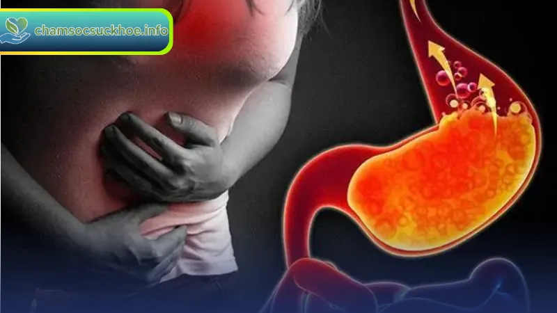 Triệu chứng thường gặp của trào ngược dạ dày
