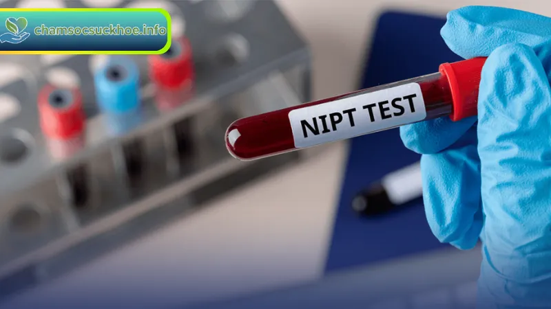 Quy trình và chi phí xét nghiệm NIPT dành cho mẹ bầu