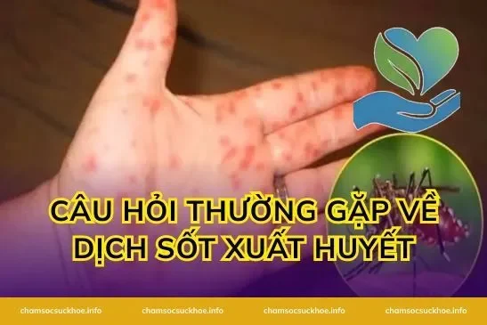 Câu hỏi thường gặp về dịch sốt xuất huyết